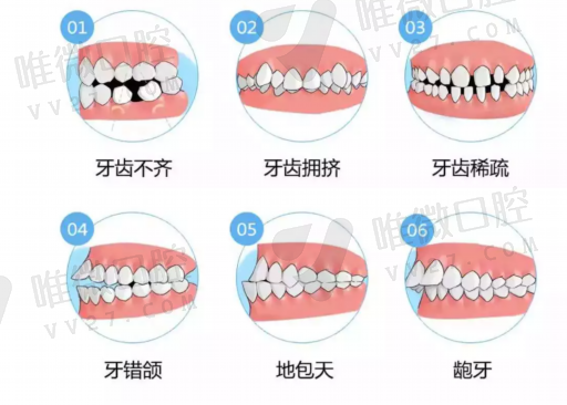 陶瓷假牙和烤瓷牙有什么区别呢,常见问题解读！(图1)